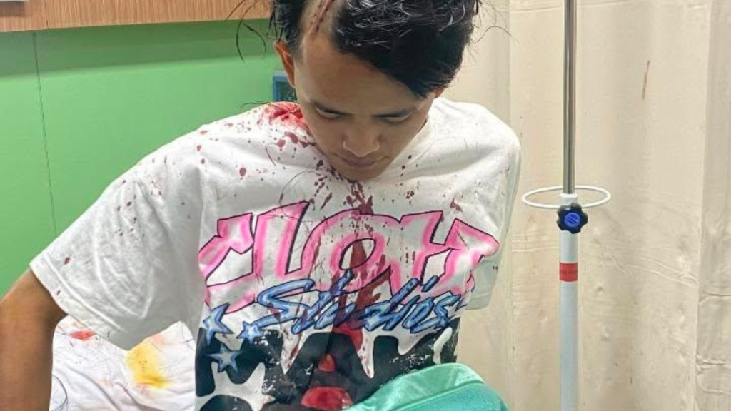 Pemuda Antapani Dibegal Tengah Malam Motor dan Uang Raib